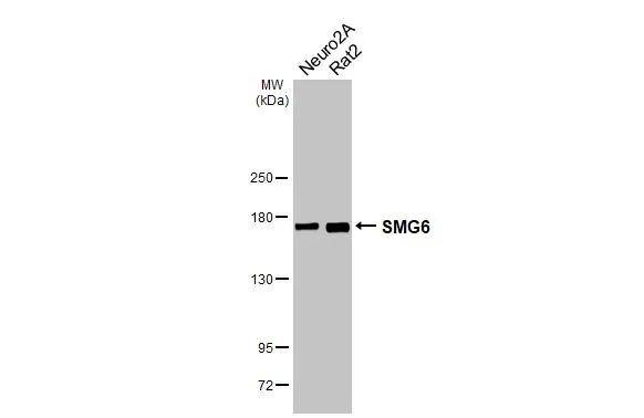 Various whole cell extracts (30 ug) were separated by 5% SDS-PAGE, and the membrane was blotted with SMG6 antibody [HL3274] (NBP3-48787) diluted at 1:1000. The HRP-conjugated anti-rabbit IgG antibody was used to detect the primary antibody. 