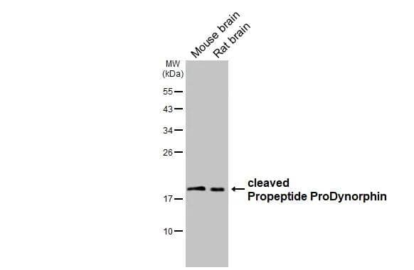 Various tissue extracts (50 ug) were separated by 12% SDS-PAGE, and the membrane was blotted with Prodynorphin/PDYN antibody [HL3295] (NBP3-48788) diluted at 1:1000. The HRP-conjugated anti-rabbit IgG antibody was used to detect the primary antibody. 