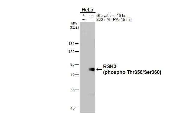 Western Blot RSK3 [p Ser360, p Thr356] Antibody (HL3299)