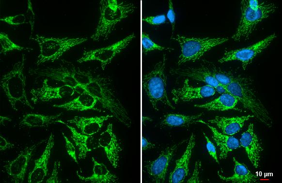 MFF antibody [GT26] detects MFF protein by immunofluorescent analysis.Sample: HeLa cells were fixed in ice-cold MeOH for 5 min.Green: MFF stained by MFF antibody [GT26] (NBP3-48790) diluted at 1:500.Blue: Fluoroshield with DAPI . 