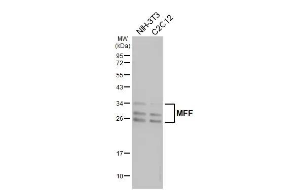 Various whole cell extracts (30 ug) were separated by 12% SDS-PAGE, and the membrane was blotted with MFF antibody [GT26] (NBP3-48790) diluted at 1:1000. The HRP-conjugated anti-mouse IgG antibody was used to detect the primary antibody, and the signal was developed with Trident ECL plus-Enhanced. 