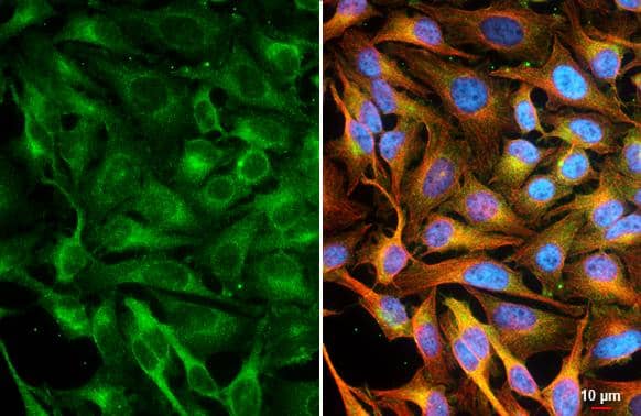 CASK antibody [GT27] detects CASK protein by immunofluorescent analysis.Sample: HeLa cells were fixed in 4% paraformaldehyde at RT for 15 min.Green: CASK stained by CASK antibody [GT27] (NBP3-48791) diluted at 1:500.Red: alpha Tubulin, a cytoskeleton marker, stained by alpha Tubulin antibody [GT114] diluted at 1:1000.Blue: Fluoroshield with DAPI . 