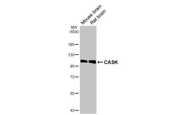 Various tissue extracts (50 ug) were separated by 7.5% SDS-PAGE, and the membrane was blotted with CASK antibody [GT27] (NBP3-48791) diluted at 1:1000. The HRP-conjugated anti-mouse IgG antibody was used to detect the primary antibody. 