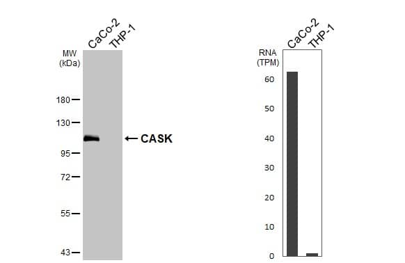 <b>Orthogonal Strategies Validation. </b>Various whole cell extracts (30 ug) were separated by 7.5% SDS-PAGE, and the membrane was blotted with CASK antibody [GT27] (NBP3-48791) diluted at 1:1000. The HRP-conjugated anti-mouse IgG antibody was used to detect the primary antibody. Corresponding RNA expression data for the same cell lines are based on Human Protein Atlas program. 