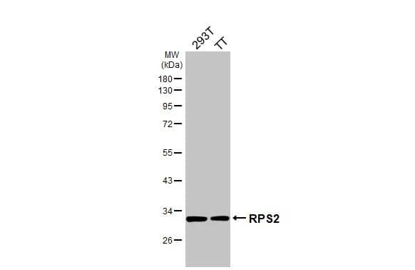 Various whole cell extracts (30 ug) were separated by 10% SDS-PAGE, and the membrane was blotted with RPS2 antibody [HL3338] (NBP3-48792) diluted at 1:3000. The HRP-conjugated anti-rabbit IgG antibody was used to detect the primary antibody. 