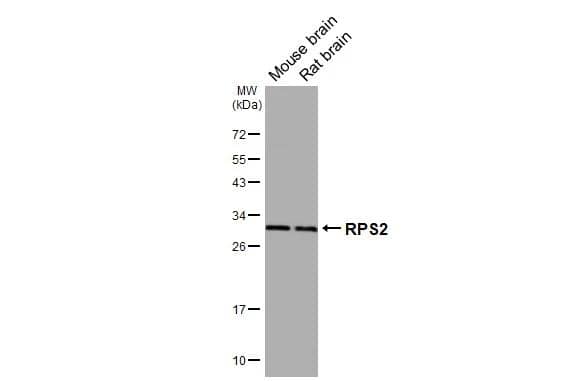 Various tissue extracts (50 ug) were separated by 12% SDS-PAGE, and the membrane was blotted with RPS2 antibody [HL3338] (NBP3-48792) diluted at 1:1000. The HRP-conjugated anti-rabbit IgG antibody was used to detect the primary antibody. 