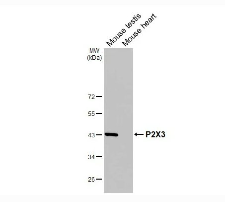 Various tissue extracts (50 μg) were separated by 10% SDS-PAGE, and the membrane was blotted with P2X3 antibody [HL3347] diluted at 1:1000. The HRP-conjugated anti-rabbit IgG antibody (NBP2-19301) was used to detect the primary antibody.