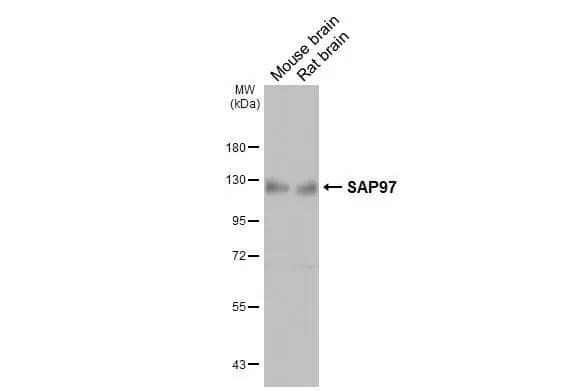 Various tissue extracts (50 ug) were separated by 7.5% SDS-PAGE, and the membrane was blotted with DLG1 antibody (NBP3-48794) diluted at 1:500. The HRP-conjugated anti-mouse IgG antibody was used to detect the primary antibody. 