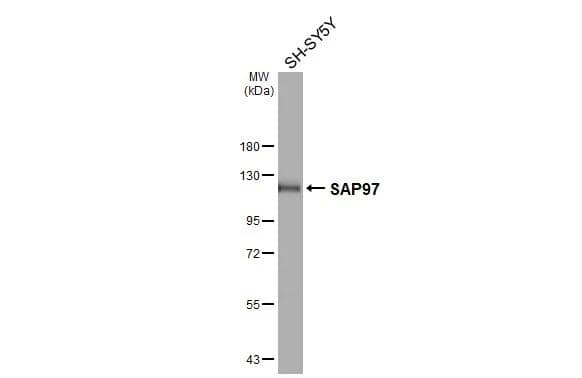 Various whole cell extracts (30 ug) was separated by 7.5% SDS-PAGE, and the membrane was blotted with DLG1 antibody [GT31] (NBP3-48794) diluted at 1:1000. The HRP-conjugated anti-mouse IgG antibody was used to detect the primary antibody, and the signal was developed with Trident ECL plus-Enhanced. 