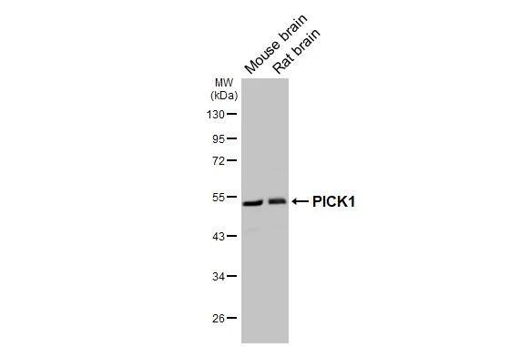 <b>Orthogonal Strategies Validation. </b>Various tissue extracts (50 ug) were separated by 10% SDS-PAGE, and the membrane was blotted with PICK1 antibody [GT32] (NBP3-48795) diluted at 1:1000. The HRP-conjugated anti-mouse IgG antibody was used to detect the primary antibody. 