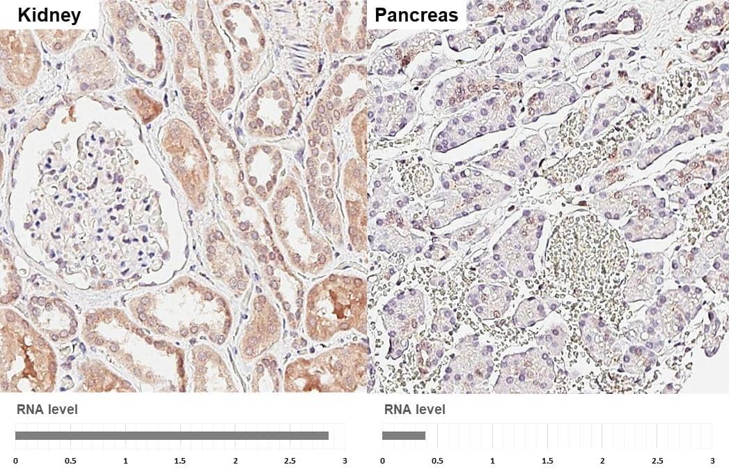 <b>Orthogonal Strategies Validation. </b>Suppressor of Fused antibody [HL3374] detects Suppressor of Fused protein by immunohistochemical analysis.Sample: Paraffin-embedded human tissues.Suppressor of Fused stained by Suppressor of Fused antibody [HL3374] (NBP3-48798) diluted at 1:250.Antigen Retrieval: Citrate buffer, pH 6.0, 15 min 