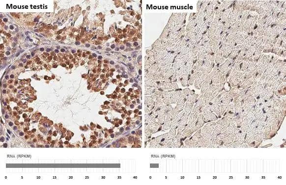 Suppressor of Fused antibody [HL3374] detects Suppressor of Fused protein by immunohistochemical analysis.Sample: Paraffin-embedded mouse tissues.Suppressor of Fused stained by Suppressor of Fused antibody [HL3374] (NBP3-48798) diluted at 1:100.Antigen Retrieval: Citrate buffer, pH 6.0, 15 minCorresponding RNA expression data for the same tissues are based on NCBI. 