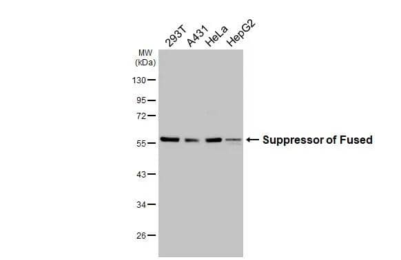 <b>Orthogonal Strategies Validation. </b>Various whole cell extracts (30 ug) were separated by 10% SDS-PAGE, and the membrane was blotted with Suppressor of Fused antibody [HL3374] (NBP3-48798) diluted at 1:1000. The HRP-conjugated anti-rabbit IgG antibody was used to detect the primary antibody. 