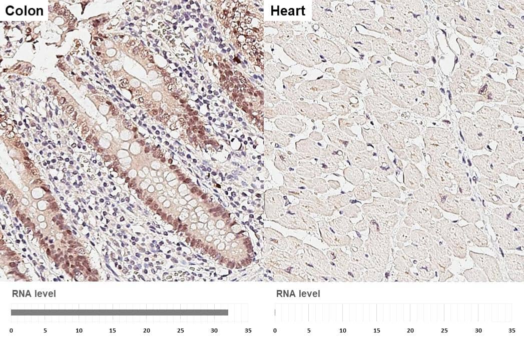 <b>Orthogonal Strategies Validation. </b>ESRP1 antibody [HL3413] detects ESRP1 protein by immunohistochemical analysis.Sample: Paraffin-embedded human tissues.ESRP1 stained by ESRP1 antibody [HL3413] (NBP3-48799) diluted at 1:100.Antigen Retrieval: Citrate buffer, pH 6.0, 15 min 