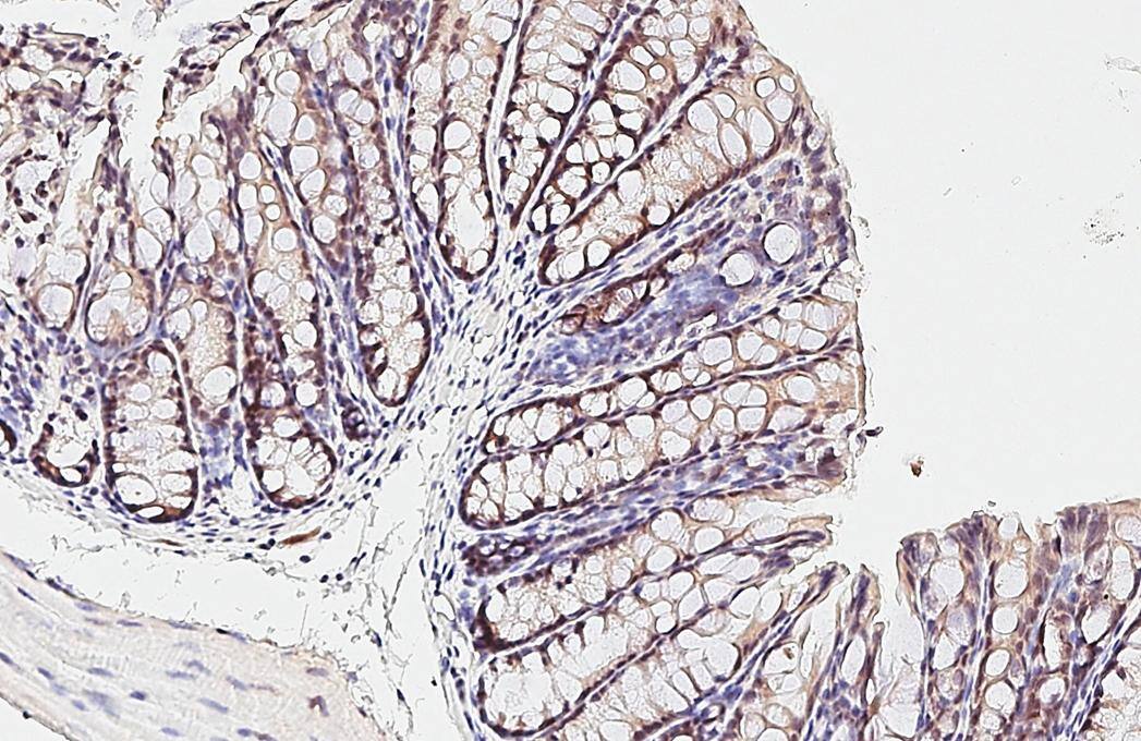 ESRP1 antibody [HL3413] detects ESRP1 protein by immunohistochemical analysis.Sample: Paraffin-embedded mouse colon.ESRP1 stained by ESRP1 antibody [HL3413] (NBP3-48799) diluted at 1:100.Antigen Retrieval: Citrate buffer, pH 6.0, 15 min 