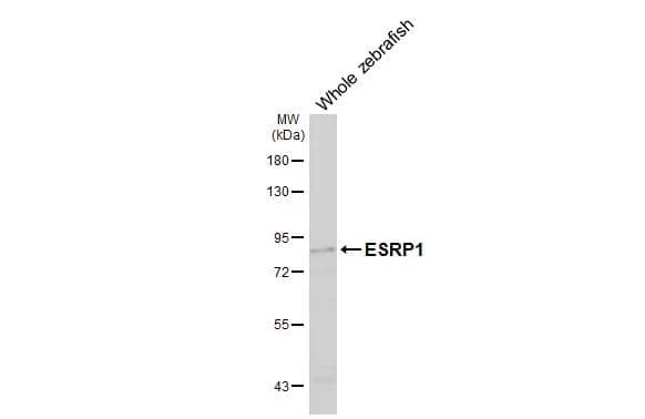Whole zebrafish extract (30 ug) was separated by 7.5% SDS-PAGE, and the membrane was blotted with ESRP1 antibody [HL3413] (NBP3-48799) diluted at 1:1000. The HRP-conjugated anti-rabbit IgG antibody was used to detect the primary antibody, and the signal was developed with Trident ECL plus-Enhanced. 