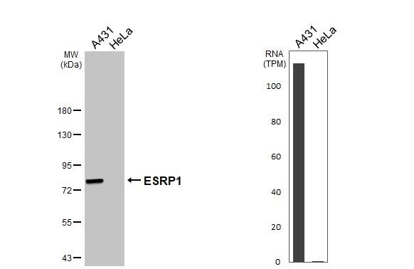 <b>Orthogonal Strategies Validation. </b>Various whole cell extracts (30 ug) were separated by 7.5% SDS-PAGE, and the membrane was blotted with ESRP1 antibody [HL3413] (NBP3-48799) diluted at 1:1000. The HRP-conjugated anti-rabbit IgG antibody was used to detect the primary antibody. Corresponding RNA expression data for the same cell lines are based on Human Protein Atlas program. 