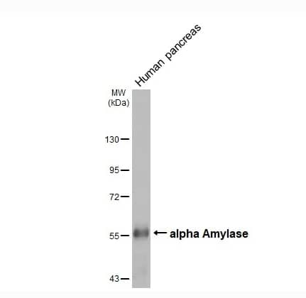 Western Blot Alpha Amylase Antibody (HL1681)