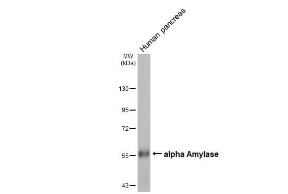 Western Blot Alpha Amylase Antibody (HL1681)
