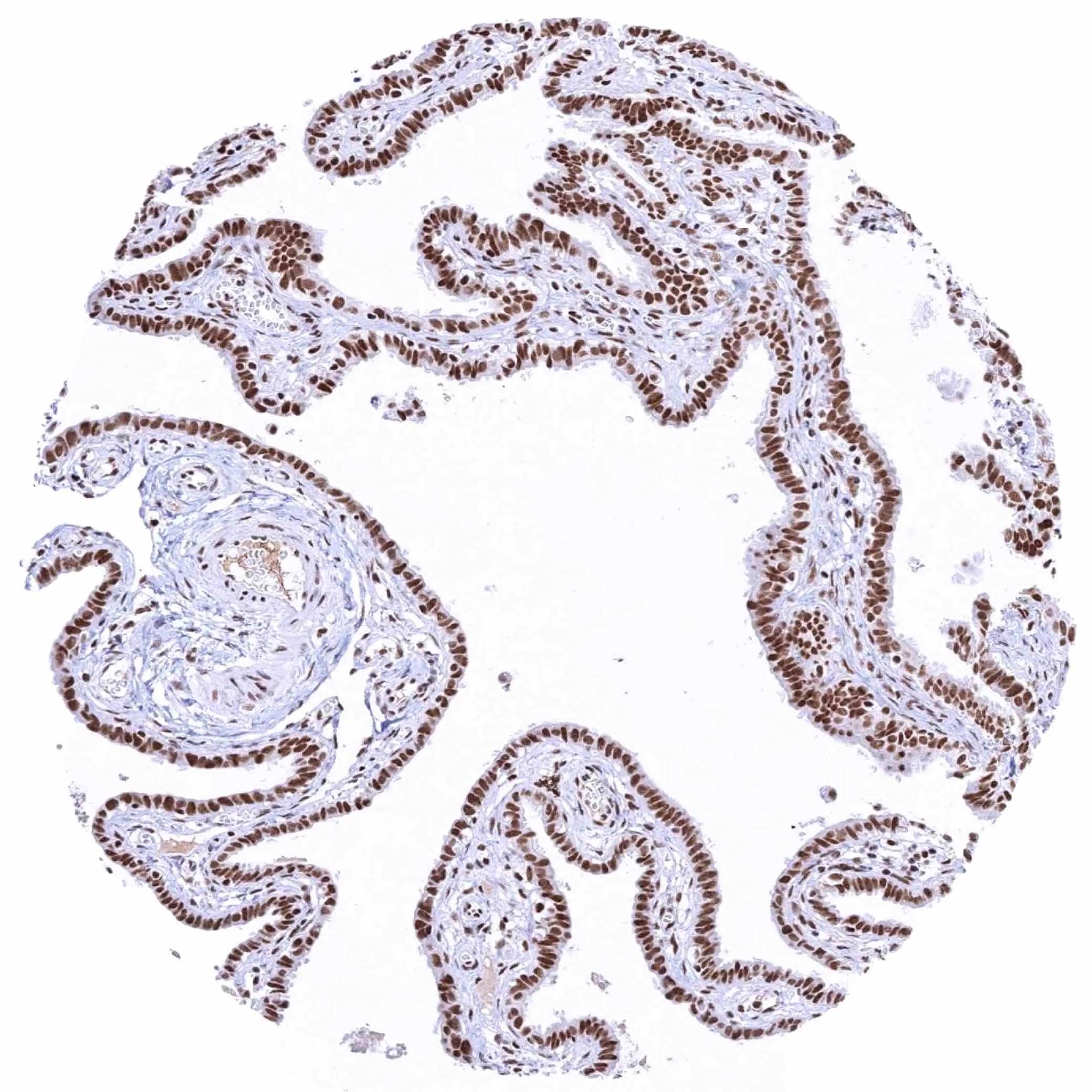 IHC-P analysis of human fallopian tube mucosa tissue using KDM6A antibody (HMV311).Strong nuclear KDM6A staining of all epithelial cells.