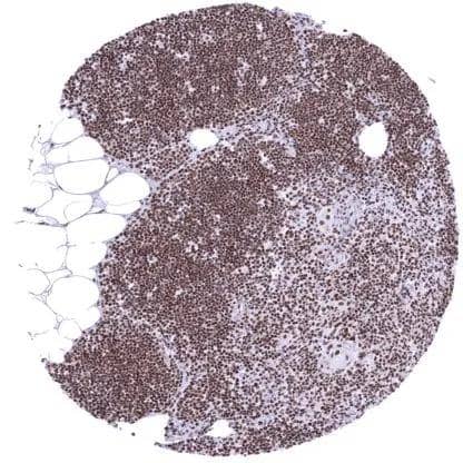 IHC-P analysis of human thymus tissue using KDM6A antibody (HMV311).An intense nuclear KDM6A staining of all cell types.