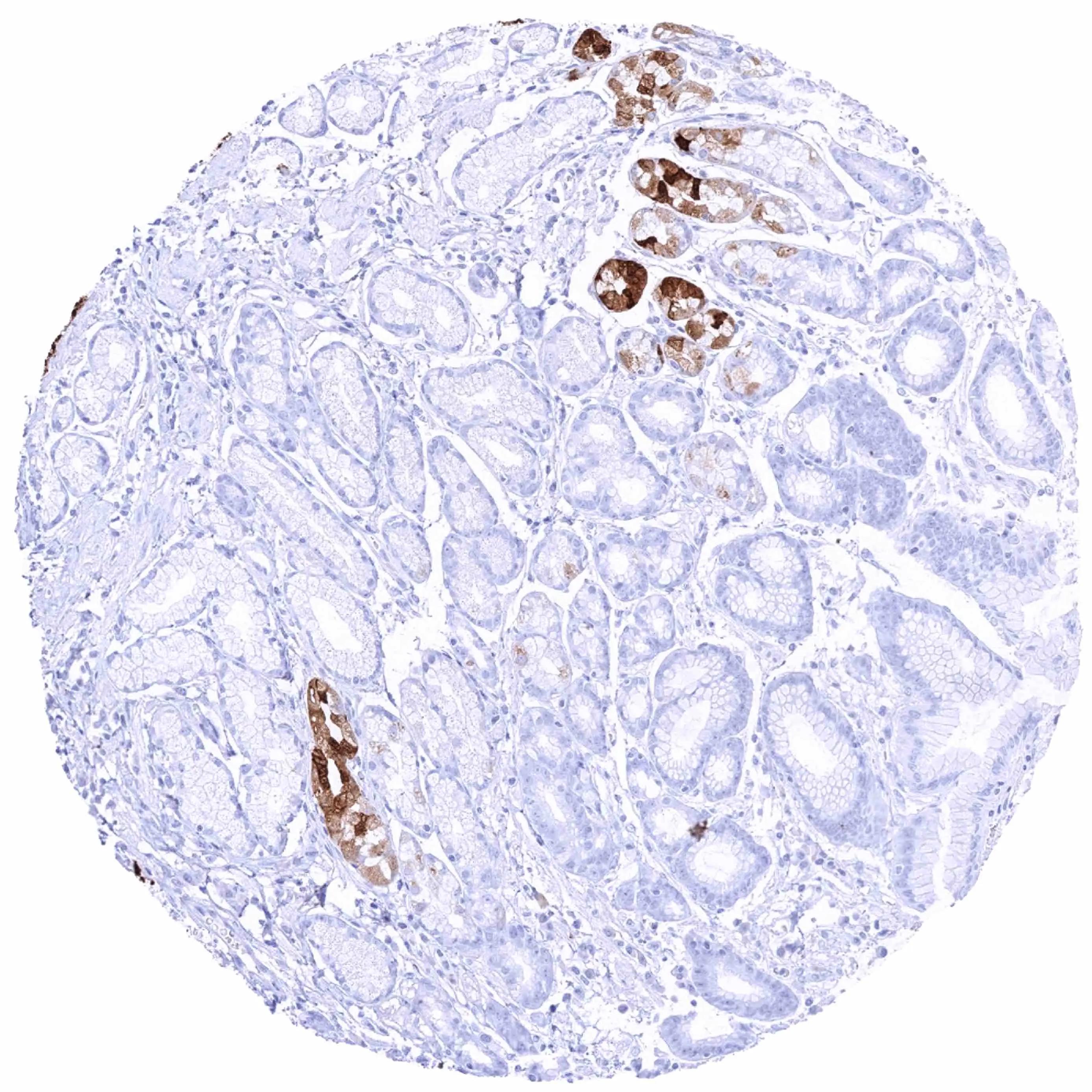 Immunohistochemistry-Paraffin Pepsinogen I Antibody (HMV318)