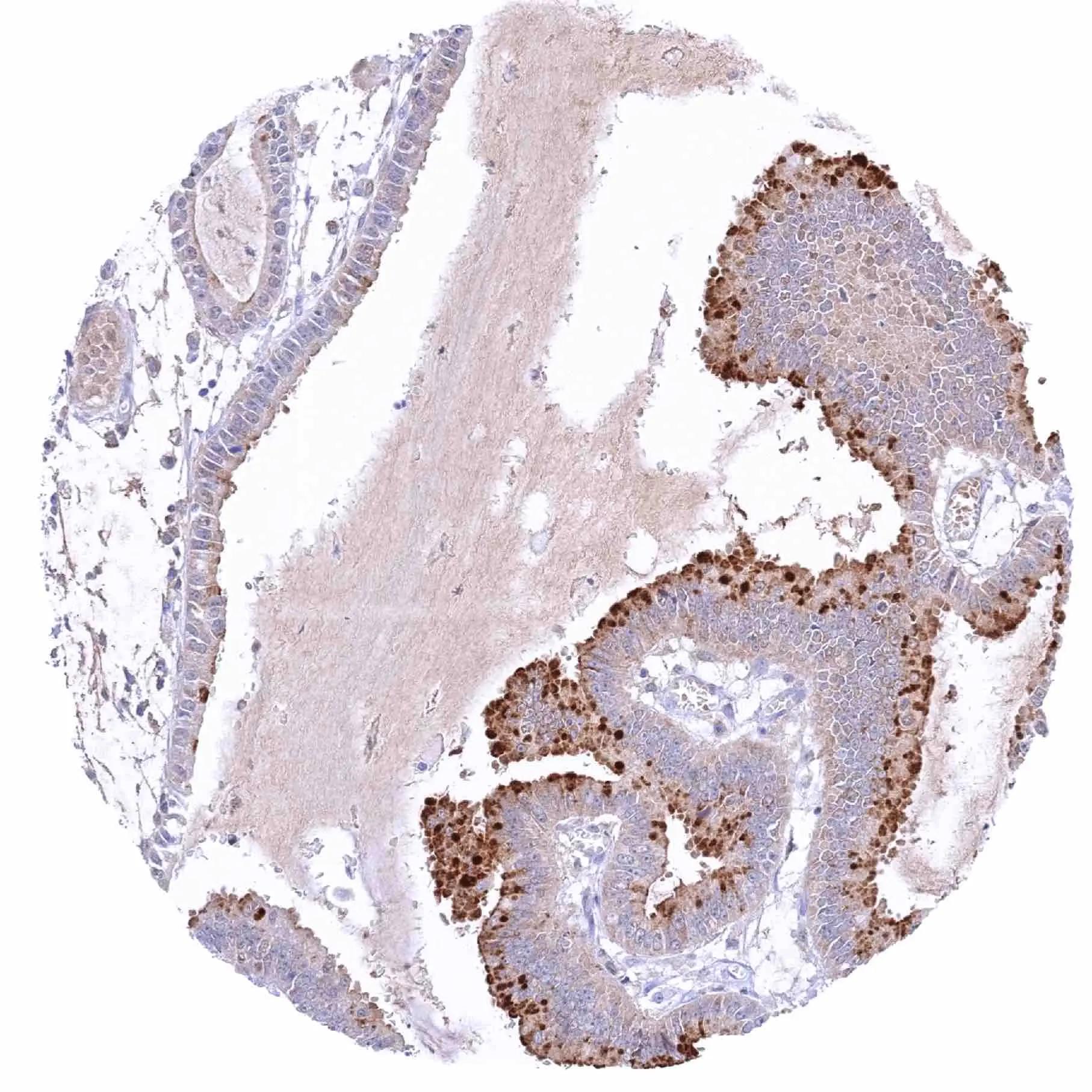 Immunohistochemistry-Paraffin Pepsinogen I Antibody (HMV318)