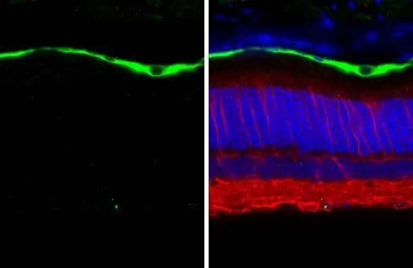 Immunohistochemistry-Paraffin RGR Antibody (HL3058)