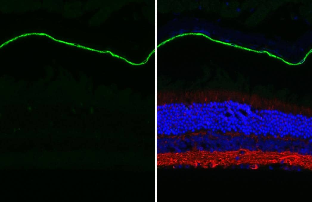 RGR antibody [HL3056 + HL3058] detects RGR protein by immunohistochemical analysis.Sample: Paraffin-embedded mouse eye.Green: RGR stained by RGR antibody [HL3056 + HL3058] (NBP3-48808) diluted at 1:250.Red: beta Tubulin 3/ Tuj1 antibody diluted at 1:500.Blue: Fluoroshield with DAPI .Antigen Retrieval: Citrate buffer, pH 6.0, 15 min 