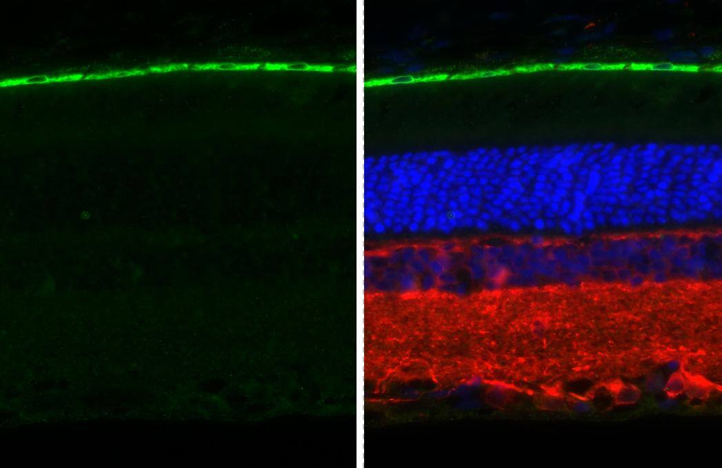 RGR antibody [HL3056 + HL3058] detects RGR protein by immunohistochemical analysis.Sample: Paraffin-embedded rat eye.Green: RGR stained by RGR antibody [HL3056 + HL3058] (NBP3-48808) diluted at 1:250.Red: beta Tubulin 3/ Tuj1 antibody diluted at 1:500.Blue: Fluoroshield with DAPI .Antigen Retrieval: Citrate buffer, pH 6.0, 15 min 