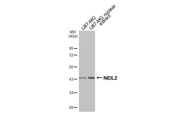 <b>Orthogonal Strategies Validation. </b>U87-MG whole cell and nuclear extracts (30 ug) were separated by 10% SDS-PAGE, and the membrane was blotted with NEIL2 antibody [HL3343] (NBP3-48809) diluted at 1:1000. The HRP-conjugated anti-rabbit IgG antibody was used to detect the primary antibody. 