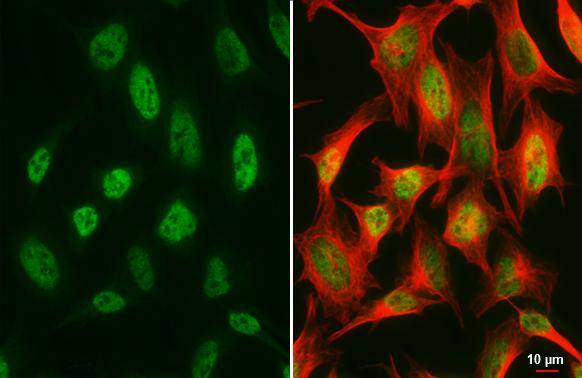 Suppressor of Fused antibody [HL3375] detects Suppressor of Fused protein by immunofluorescent analysis.Sample: HeLa cells were fixed in 4% paraformaldehyde at RT for 15 min.Green: Suppressor of Fused stained by Suppressor of Fused antibody [HL3375] (NBP3-48810) diluted at 1:500.Red: alpha Tubulin, a cytoskeleton marker, stained by alpha Tubulin antibody [GT114] diluted at 1:1000. 