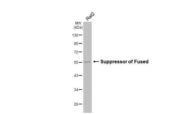 Whole cell extract (30 ug) was separated by 10% SDS-PAGE, and the membrane was blotted with Suppressor of Fused antibody [HL3375] (NBP3-48810) diluted at 1:1000. The HRP-conjugated anti-rabbit IgG antibody was used to detect the primary antibody, and the signal was developed with Trident ECL plus-Enhanced. 