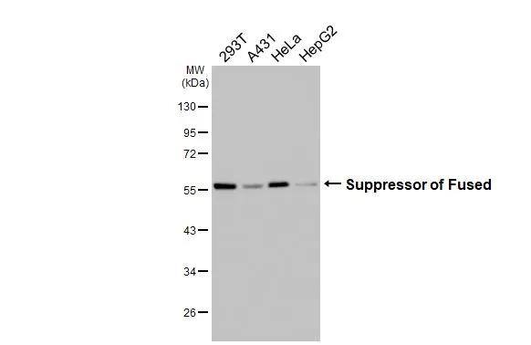 Various whole cell extracts (30 ug) were separated by 10% SDS-PAGE, and the membrane was blotted with Suppressor of Fused antibody [HL3375] (NBP3-48810) diluted at 1:1000. The HRP-conjugated anti-rabbit IgG antibody was used to detect the primary antibody. 