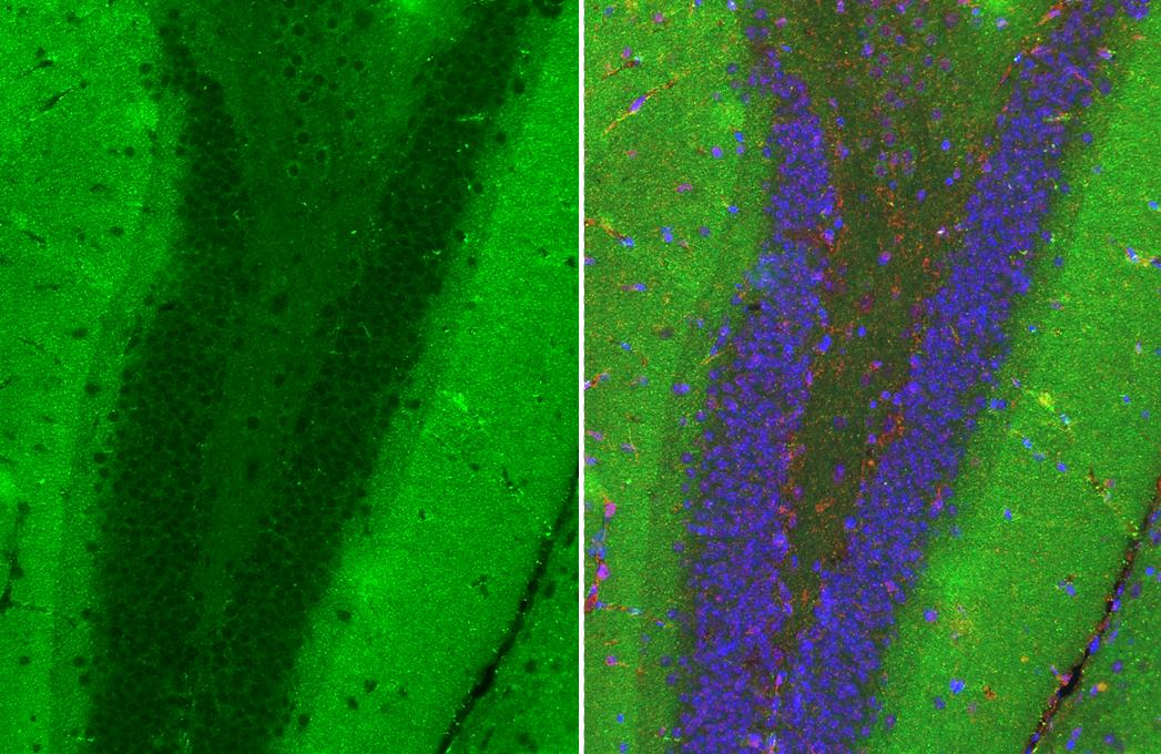 MAP3K12 antibody [HL3423] detects MAP3K12 protein by immunohistochemical analysis.Sample: Paraffin-embedded mouse hippocampus.Green: MAP3K12 stained by MAP3K12 antibody [HL3423] (NBP3-48811) diluted at 1:200.Red: NF-H antibody [GT114] diluted at 1:500.Blue: Hoechst 33342 staining.Antigen Retrieval: Tris-EDTA buffer, pH 9.0, 15 min 