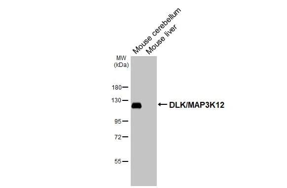 Various tissue extracts (50 �g) were separated by 7.5% SDS-PAGE, and the membrane was blotted with MAP3K12 antibody [HL3423] (NBP3-48811) diluted at 1:1000. The HRP-conjugated anti-rabbit IgG antibody was used to detect the primary antibody. 
