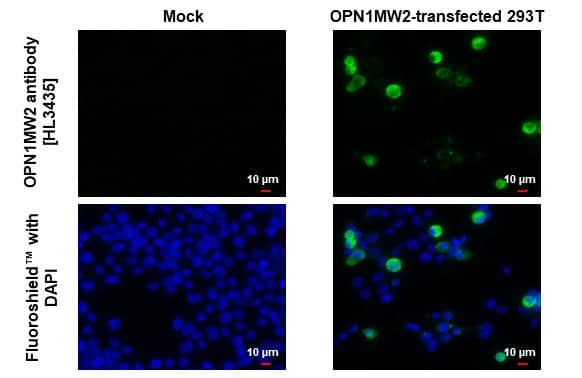 Immunocytochemistry/ Immunofluorescence Opsin 1 (Medium Wave) Antibody (HL3435)