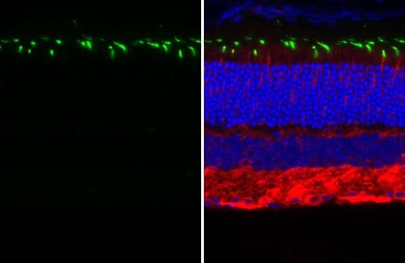 Immunohistochemistry-Paraffin Opsin 1 (Medium Wave) Antibody (HL3435)