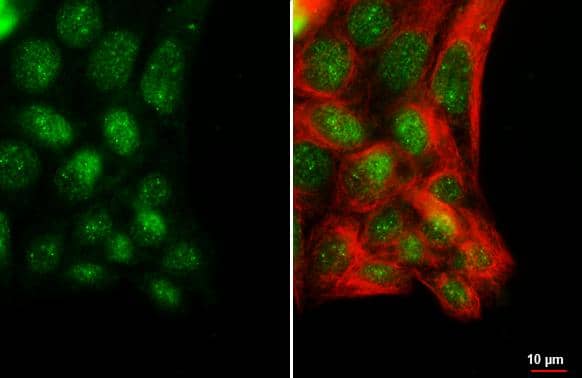 POLR3A antibody [HL3437] detects POLR3A protein by immunofluorescent analysis.Sample: HepG2 cells were fixed in ice-cold MeOH for 5 min.Green: POLR3A stained by POLR3A antibody [HL3437] (NBP3-48813) diluted at 1:500.Red: alpha Tubulin, a cytoskeleton marker, stained by alpha Tubulin antibody [GT114] diluted at 1:1000. 