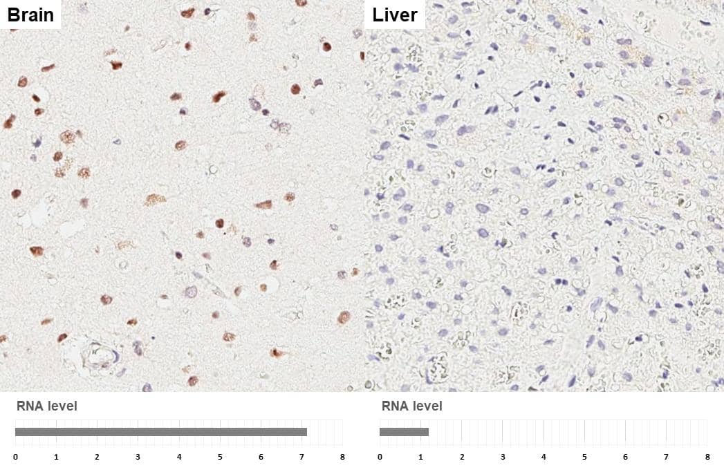 Immunohistochemistry-Paraffin POLR3A Antibody (HL3437)
