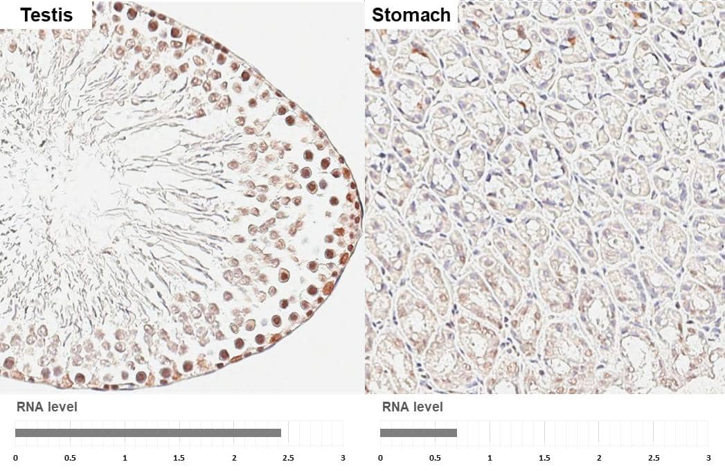 POLR3A antibody [HL3437] detects POLR3A protein by immunohistochemical analysis.Sample: Paraffin-embedded rat tissues.POLR3A stained by POLR3A antibody [HL3437] (NBP3-48813) diluted at 1:200.Antigen Retrieval: Citrate buffer, pH 6.0, 15 minCorresponding RNA levels (RPKM) in the tissues are based on NCBI database. 