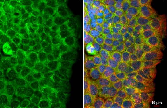 Flightless I antibody [HL3438] detects Flightless I protein by immunofluorescent analysis.Sample: A431 cells were fixed in ice-cold MeOH for 5 min.Green: Flightless I stained by Flightless I antibody [HL3438] (NBP3-48814) diluted at 1:500.Red: alpha Tubulin, a cytoskeleton marker, stained by alpha Tubulin antibody [GT114] diluted at 1:1000.Blue: Fluoroshield with DAPI . 