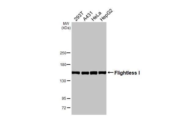 Various whole cell extracts (30 ug) were separated by 5% SDS-PAGE, and the membrane was blotted with Flightless I antibod [HL3438] (NBP3-48814) diluted at 1:1000. The HRP-conjugated anti-rabbit IgG antibody was used to detect the primary antibody. 