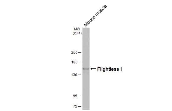 Whole tissue extract (50 ug) was separated by 5% SDS-PAGE, and the membrane was blotted with Flightless I antibod [HL3438] (NBP3-48814) diluted at 1:1000. The HRP-conjugated anti-rabbit IgG antibody was used to detect the primary antibody. 