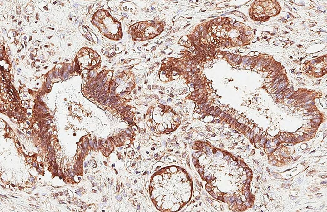 Immunohistochemistry-Paraffin HEATR7B1 Antibody (HL3448)