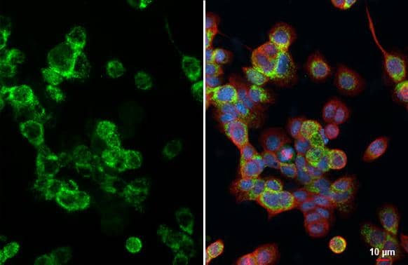 HKDC1 antibody [HL3464] detects HKDC1 protein at mitochondria by immunofluorescent analysis.Sample: AsPC-1 cells were fixed in ice-cold MeOH for 5 min.Green: HKDC1 stained by HKDC1 antibody [HL3464] (NBP3-48816) diluted at 1:500.Red: alpha Tubulin, a cytoskeleton marker, stained by alpha Tubulin antibody [GT114] diluted at 1:1000.Blue: Fluoroshield with DAPI . 