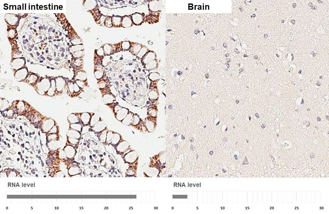 HKDC1 antibody [HL3464] detects HKDC1 protein by immunohistochemical analysis.Sample: Paraffin-embedded human tissues.HKDC1 stained by HKDC1 antibody [HL3464] (NBP3-48816) diluted at 1:200.Antigen Retrieval: Citrate buffer, pH 6.0, 15 minCorresponding RNA levels (RPKM) in the tissues are based on NCBI database. 