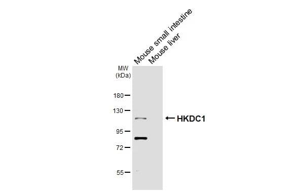 Various tissue extracts (50 ug) were separated by 7.5% SDS-PAGE, and the membrane was blotted with HKDC1 antibody [HL3464] (NBP3-48816) diluted at 1:1000. The HRP-conjugated anti-rabbit IgG antibody was used to detect the primary antibody. 
