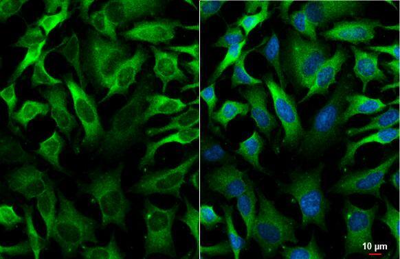 <b>Orthogonal Strategies Validation. </b>GEF-H1 antibody [HL3470] detects GEF-H1 protein by immunofluorescent analysis.Sample: HeLa cells were fixed in 4% paraformaldehyde at RT for 15 min.Green: GEF-H1 stained by GEF-H1 antibody [HL3470] (NBP3-48817) diluted at 1:500.Blue: Fluoroshield with DAPI . 