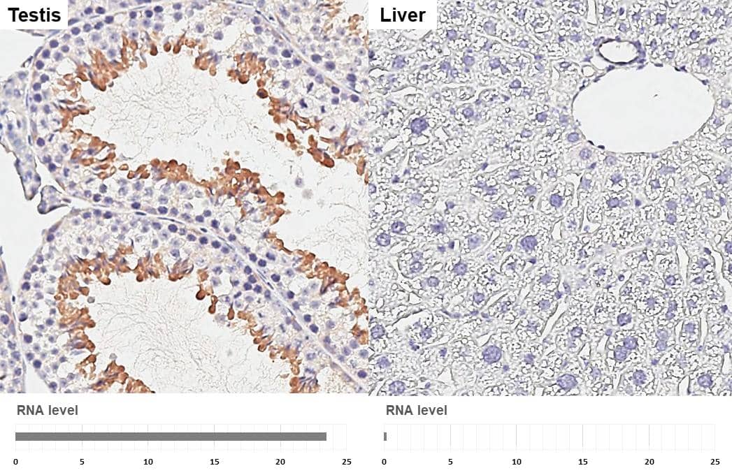 GEF-H1 antibody [HL3470] detects GEF-H1 protein by immunohistochemical analysis.Sample: Paraffin-embedded mouse tissues.GEF-H1 stained by GEF-H1 antibody [HL3470] (NBP3-48817) diluted at 1:200.Antigen Retrieval: Citrate buffer, pH 6.0, 15 minCorresponding RNA levels (RPKM) in the tissues are based on NCBI database. 